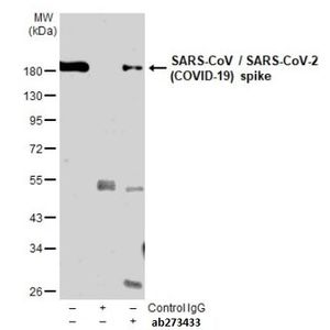 Anti-Sarcomeric Alpha Actinin antibody(AB137346)