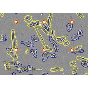Incucyte® Chemotaxis Cell Invasion & Migration Software