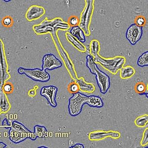 Incucyte® Chemotaxis Cell Invasion & Migration Software