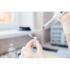 Antibiotic-Antimycotic 100X