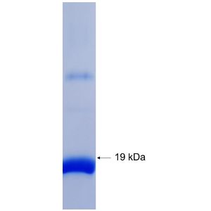 Recombinant Human AKT1 protein, His-tagged