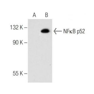 NFκB p52 (C-5)