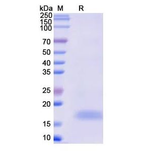 Recombinant Monkeypox virus A29L Protein, His-tagged