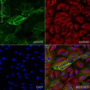 Anti-CD31 antibody [JC/70A]