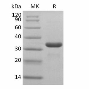 "2019-nCoV 3C-like Proteinase (E. coli, N-6His)"