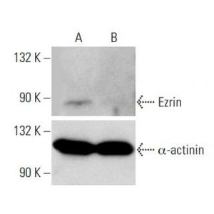 Ezrin siRNA (h)
