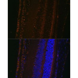 Anti-LOXL1 antibody