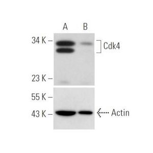 Cdk4 siRNA (h)