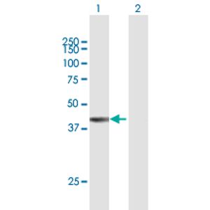 Anti-Ki67 antibody [B56](AB279653)