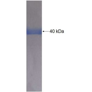Recombinant Human ALDH3A2 protein, His-tagged