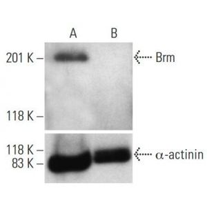 Brm siRNA (h)
