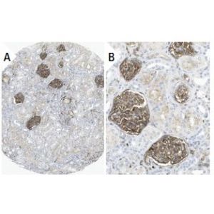 SIRP-α/β (A-1) HRP