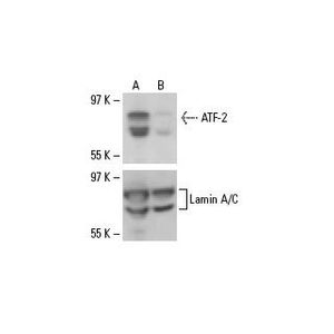 ATF-2 siRNA (h)