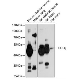 Anti-COLQ antibody