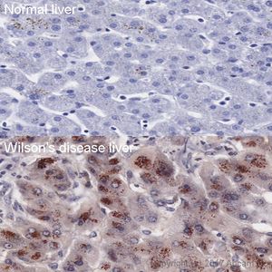 Anti-MMP14 antibody [EP1264Y](AB51074)