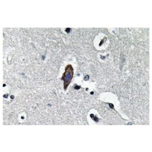 Anti-Histone H3 (tri methyl K9) antibody [EPR16601] - ChIP Grade(AB176916)