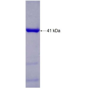 Recombinant Human ANAPC5 protein, His-tagged