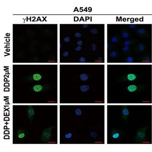 Anti-gamma H2A.X (phospho S139) antibody [EP854(2)Y]