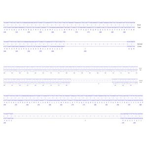 Anti-VEGFA antibody [EP1176Y] - C-terminal(AB52917)