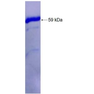 Recombinant Human AKR7A2 Protein, GST-tagged