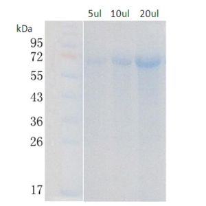 Recombinant Human ALOX12 Protein