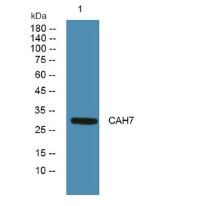 Anti-CAH7 antibody
