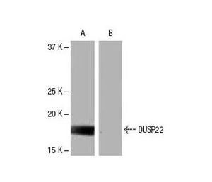 DUSP22 (9J2) | Science Company | Labroots