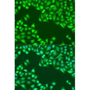 Anti-JAK2 antibody