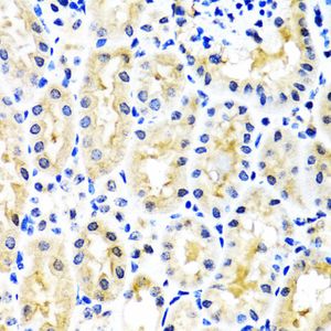 Anti-SNAP29 antibody