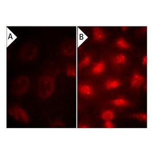 Phosphatase Inhibitor Cocktail A