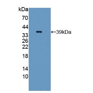 Anti-MMP9 antibody [EP1254](AB76003)