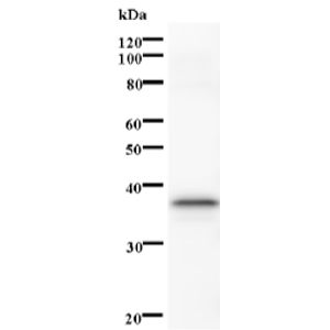 Anti-FACL4 antibody [EPR8640](AB155282)