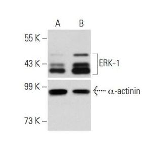ERK 1 shRNA Plasmid (h)