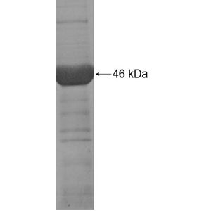 Recombinant Human ADH1A protein, His-tagged