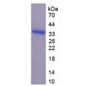 Recombinant Human AHR protein, His-tagged