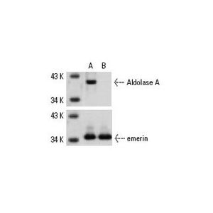 Aldolase A siRNA (h)
