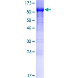 Human FGF21 ELISA Kit(AB222506)