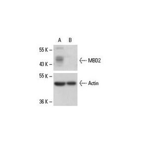 MBD2 siRNA (h)
