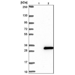 Anti-Tau (phospho S396) antibody [EPR2731](AB109390)