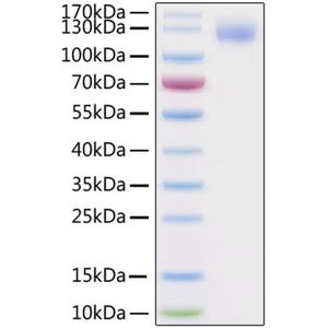 2019-nCoV Spike S1 Protein (Avi and His-Tag)