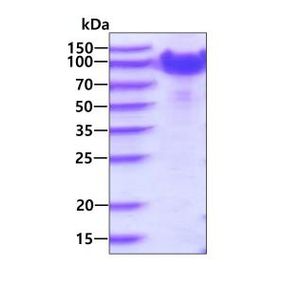 Active Recombinant Mouse Alcam Protein, hIgG/His-tagged