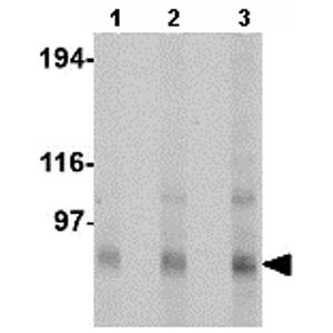 Anti-Sarcomeric Alpha Actinin antibody [EA-53](AB9465)