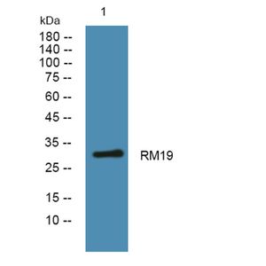 Anti-RM19 antibody