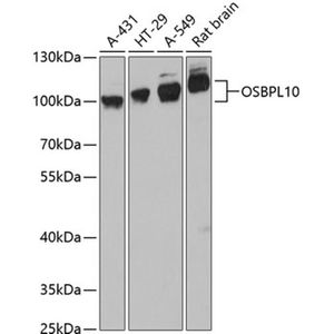 Anti-OSBPL10 antibody