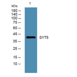 Anti-SYT5 antibody