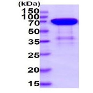 Anti-MLKL (phospho S358) antibody [EPR9514](AB187091)