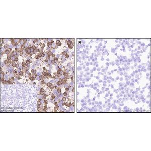 Anti-DDDDK tag (Binds to FLAG® tag sequence) antibody [EPR20018-251]
