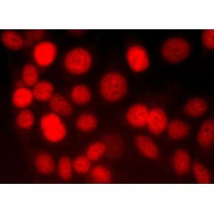 mouse anti-goat IgG-TR