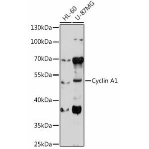 Anti-CCNA1 antibody