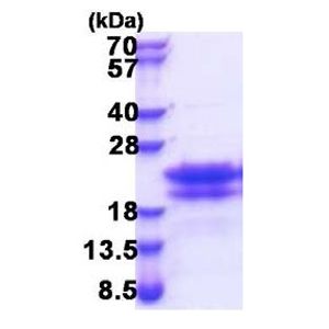Anti-PAX6 antibody [EPR15858](AB195045)
